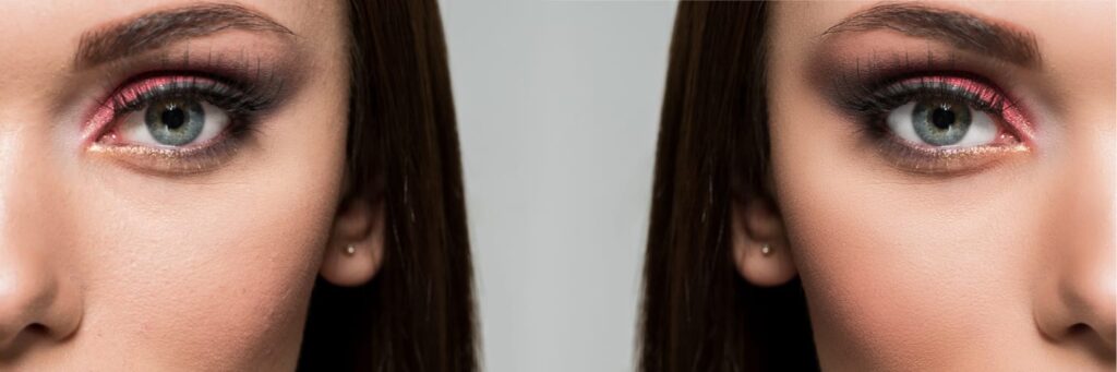 Épilation laser sécurisée réalisée par le Dr Patricia Lemeunier à Metz